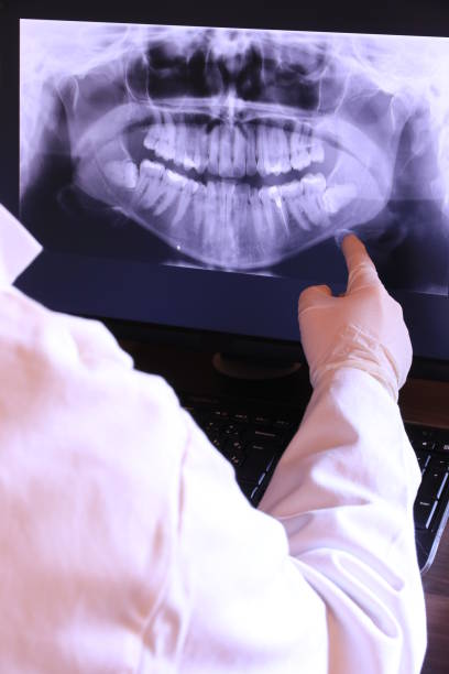 Best Emergency Root Canal Therapy in Edwardsburg, MI