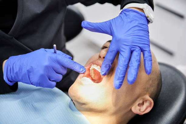 Best Dental Abscess Treatment in Edwardsburg, MI
